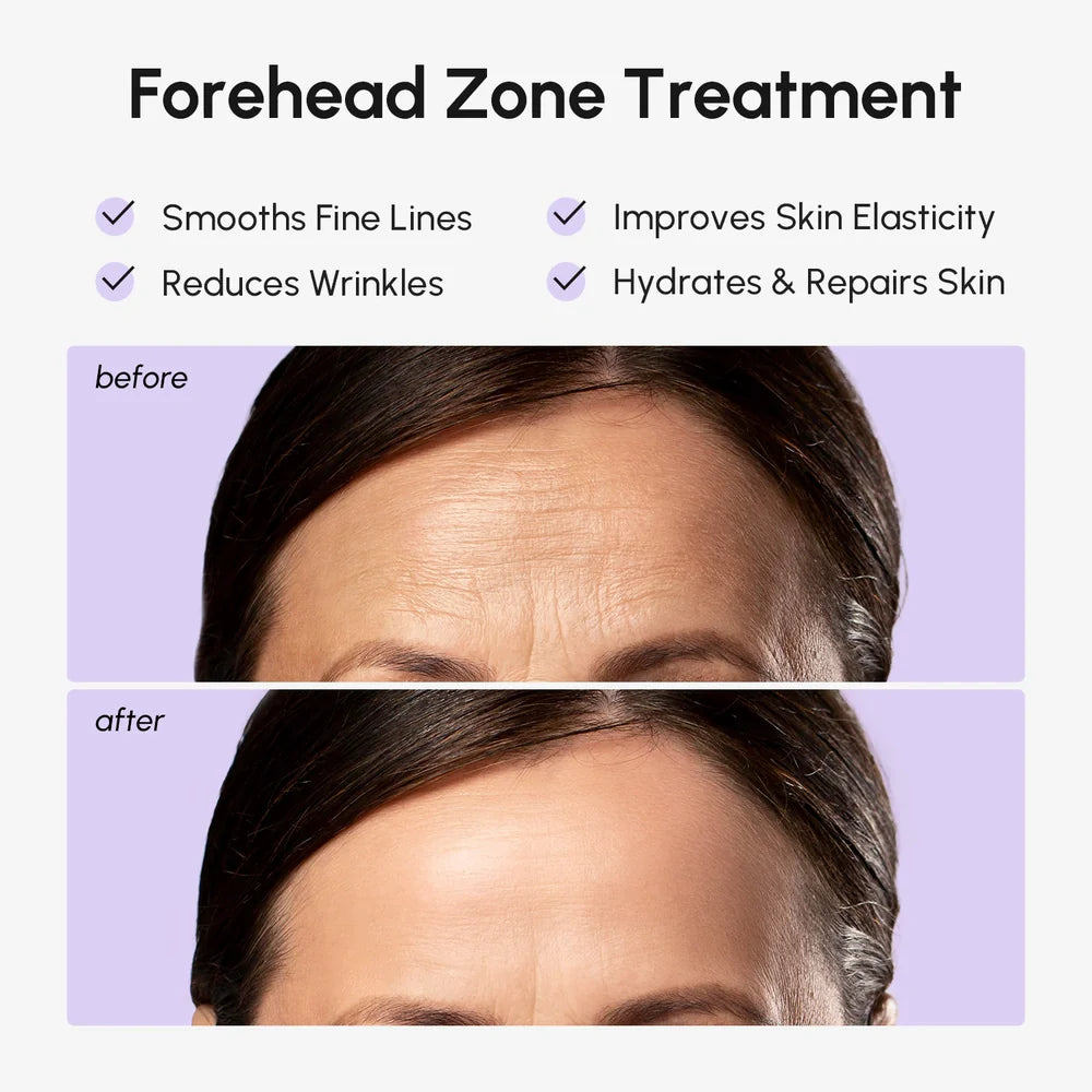 Anti-Wrinkle Forehead Patches – Skin Care